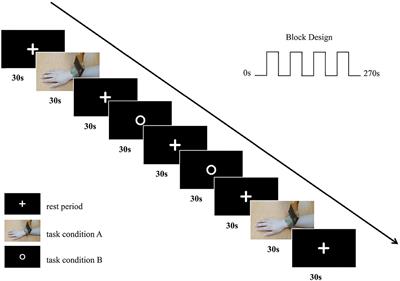 Comparison of Sensory Observation and Somatosensory Stimulation in Mirror Neurons and the Sensorimotor Network: A Task-Based fMRI Study